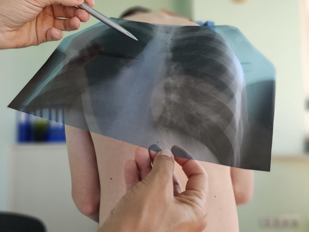 Photo of Pediatric X-ray