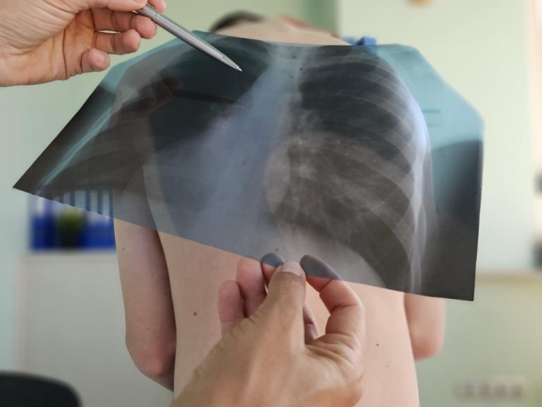 Photo of Pediatric X-ray